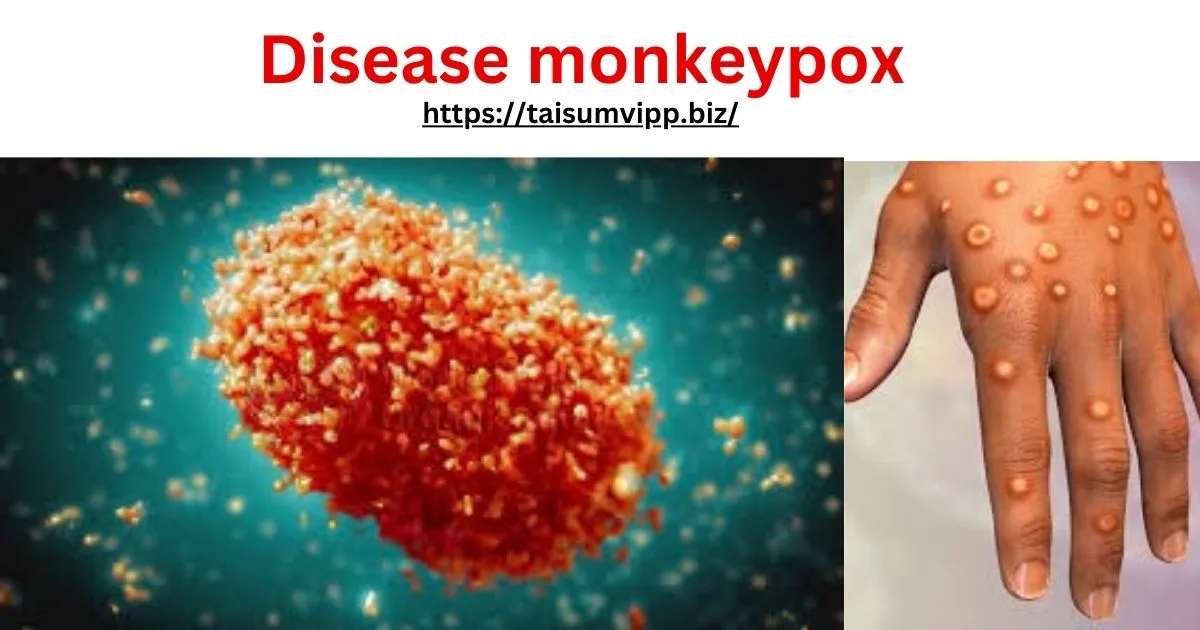 disease monkeypox